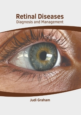 Retinal Diseases: Diagnosis and Management - 