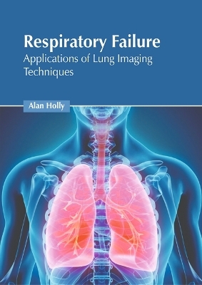 Respiratory Failure: Applications of Lung Imaging Techniques