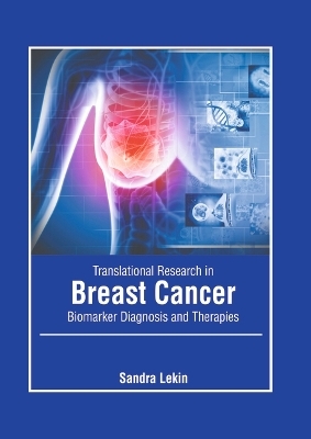 Translational Research in Breast Cancer: Biomarker Diagnosis and Therapies - 