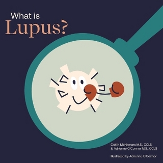 What Is Lupus?