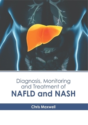 Diagnosis, Monitoring and Treatment of Nafld and Nash - 