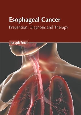 Esophageal Cancer: Prevention, Diagnosis and Therapy - 