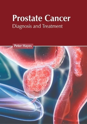 Prostate Cancer: Diagnosis and Treatment - 