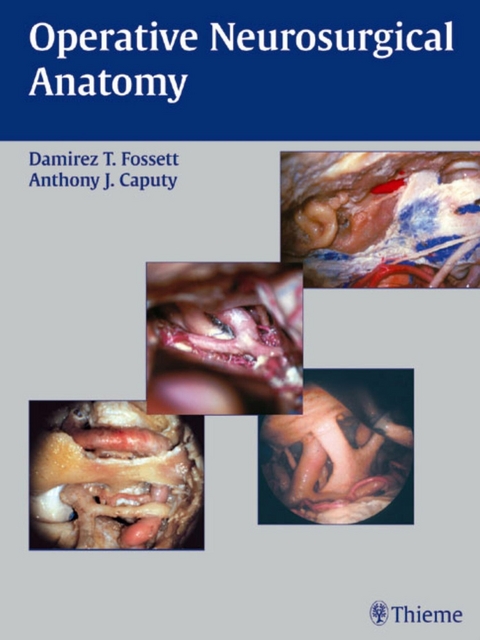 Operative Neurosurgical Anatomy -  Damirez T. Fossett,  Anthony J. Caputy