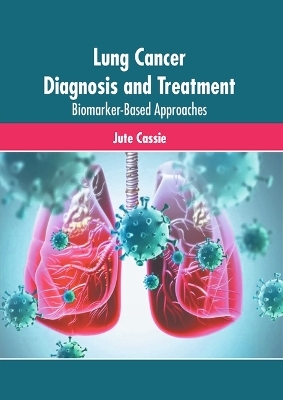 Lung Cancer Diagnosis and Treatment: Biomarker-Based Approaches - 