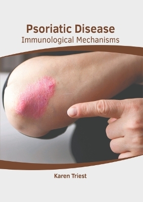 Psoriatic Disease: Immunological Mechanisms