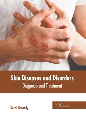 Skin Diseases and Disorders: Diagnosis and Treatment - 