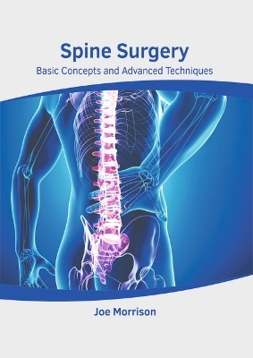 Spine Surgery: Basic Concepts and Advanced Techniques