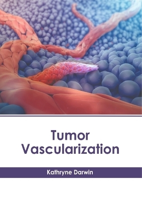 Tumor Vascularization - 