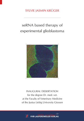 seRNA based therapy of experimental glioblastoma