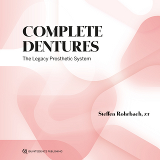 Complete Dentures