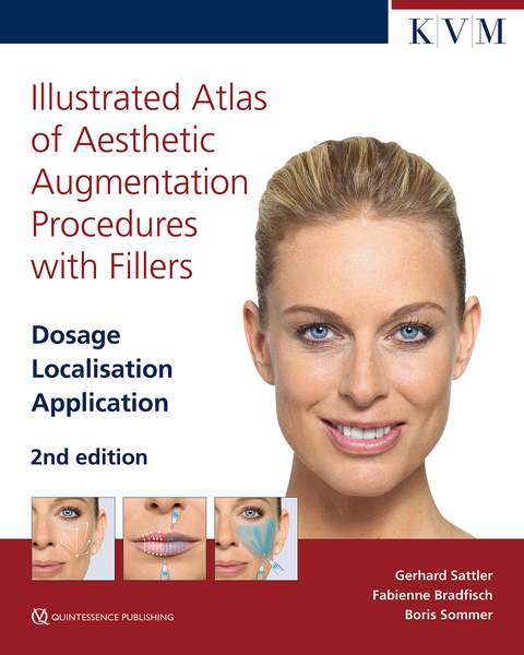Illustrated Atlas of Aesthetic Augmentation Procedures with Fillers - Gerhard Sattler, Fabienne Bradfisch, Boris Sommer