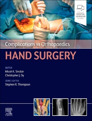 Complications in Orthopaedics: Hand Surgery - 