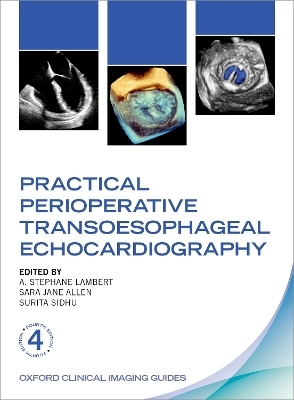 Practical Perioperative Transoesophageal Echocardiography - 
