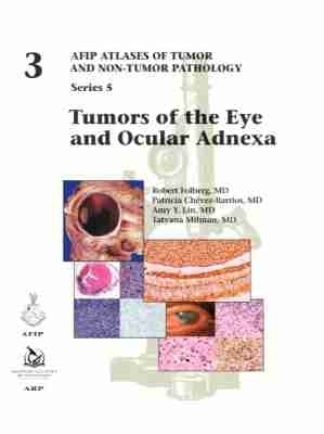 Tumors of the Eye and Ocular Adnexa - Robert Folberg, Patricia Ch&eacute;vez-Barrios, Amy Y. Lin, Tatyana Millman