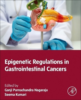 Epigenetic Regulations in Gastrointestinal Cancers