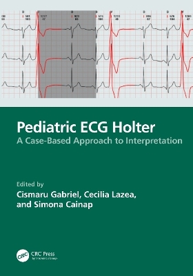 Pediatric ECG Holter