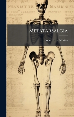 Metatarsalgia - 