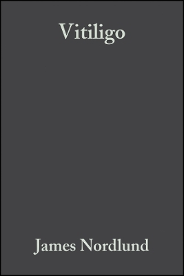 Vitiligo &ndash; A Monograph on the Basic and Clinical Science  (Foreword by Aaron B. Lerner) - S&ndash;K Hann