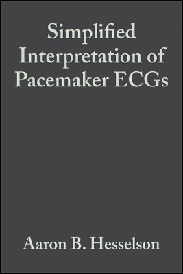 Simplified Interpretation of Pacemaker ECGs