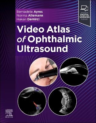 Video Atlas of Ophthalmic Ultrasound - Bernadete Ayres, Norma Allemann, Hakan Demirci