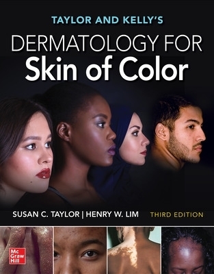 Taylor and Kelly's Dermatology for Skin of Color, Third Edition - Susan Taylor, Henry Lim