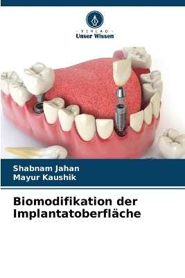 Biomodifikation der Implantatoberfläche