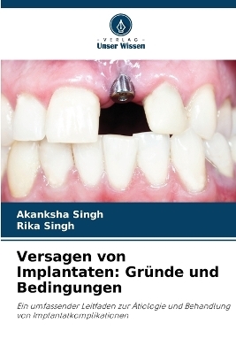 Versagen von Implantaten