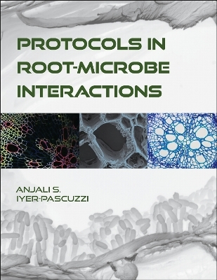 Protocols in Root-Microbe Interactions