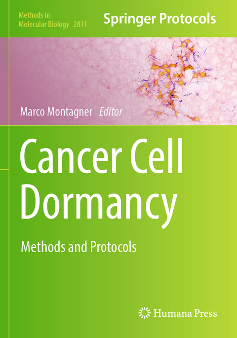 Cancer Cell Dormancy - 