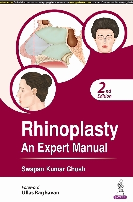 Rhinoplasty - Swapan Kumar Ghosh