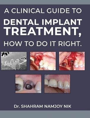 A clinical guide to dental implant treatment, how to do it right. - Dr Shahram Namjoy Nik