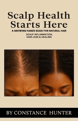 Scalp Health Starts Here
