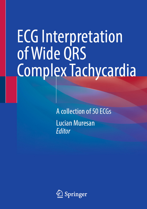 ECG Interpretation of Wide QRS Complex Tachycardia  - 