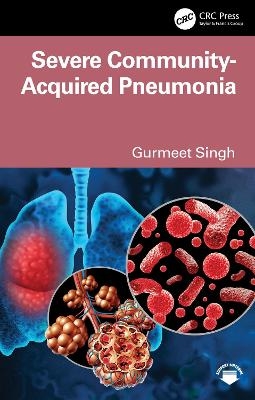 Severe Community-Acquired Pneumonia - Gurmeet Singh