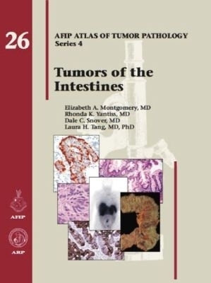Tumors of the Intestines - Elizabeth A. Montgomery, Rhonda K. Yantiss, Dale C. Snover, Laura H. Tang