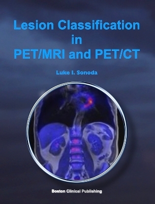 Lesion Classification in PET/MRI and PET/CT - Luke Ienari Sonoda