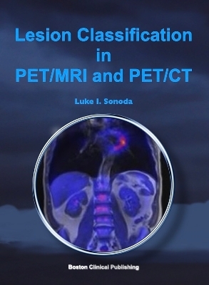 Lesion Classification in PET/MRI and PET/CT