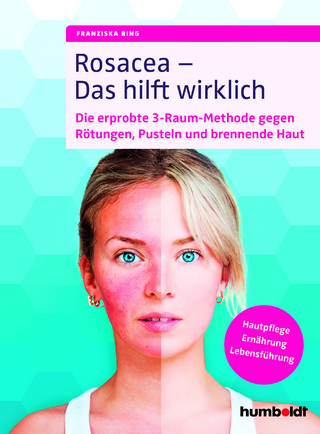 Rosacea – Das hilft wirklich