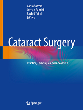 Cataract Surgery