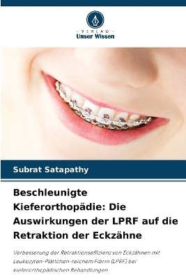 Beschleunigte Kieferorthopädie: Die Auswirkungen der LPRF auf die Retraktion der Eckzähne