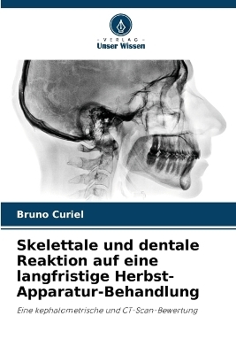 Skelettale und dentale Reaktion auf eine langfristige Herbst-Apparatur-Behandlung - Bruno Curiel