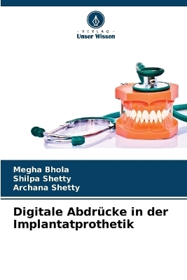 Digitale AbdrÃ¼cke in der Implantatprothetik