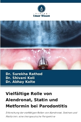 Vielf&auml;ltige Rolle von Alendronat, Statin und Metformin bei Parodontitis - Dr Surekha Rathod, Dr Shivani Koli, Dr Abhay Kolte