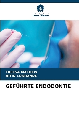 Gef&uuml;hrte Endodontie - TREESA MATHEW, Nitin Lokhande