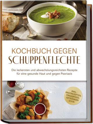 Kochbuch gegen Schuppenpflechte: Die leckersten und abwechslungsreichsten Rezepte für eine gesunde Haut und gegen Psoriasis - inkl. Brotrezepten, Fingerfood, Getränken u.v.m.