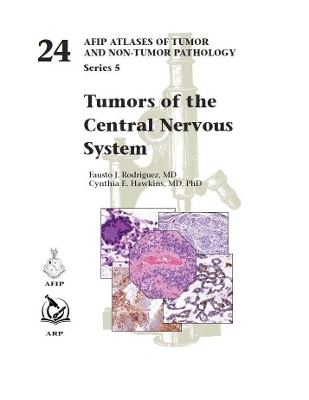 Tumors of the Central Nervous System - Fausto J. Rodriguez, Cynthia E. Hawkins