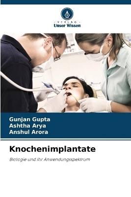 Knochenimplantate - Gunjan Gupta, Ashtha Arya, Anshul Arora