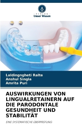 Auswirkungen Von Lingualretainern Auf Die Parodontale Gesundheit Und Stabilit&auml;t - Laldingngheti Ralte, ANSHUL SINGLA, Amrita Puri
