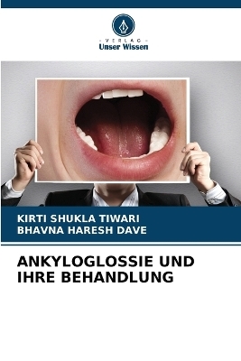 Ankyloglossie Und Ihre Behandlung